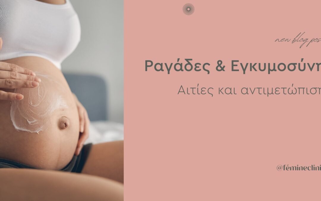 Ραγάδες & Εγκυμοσύνη | Αιτίες και αντιμετώπιση